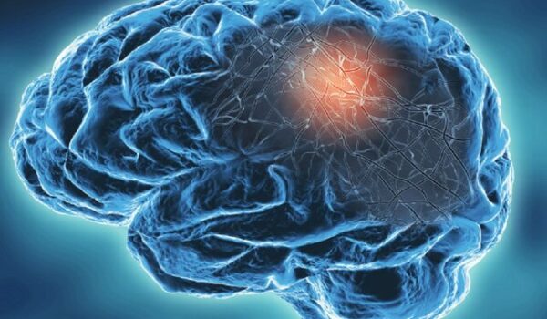 ابتلای شدید به کرونا مغز را ۲۰ سال پیر می‌کند! ابتلای شدید به کرونا مغز را ۲۰ سال پیر می‌کند!